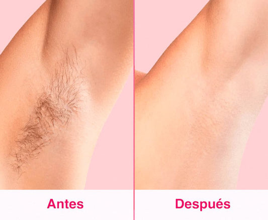 Depiladora Láser Permanente SkinUp – Eliminación de Vello Rápida y Sin Dolor